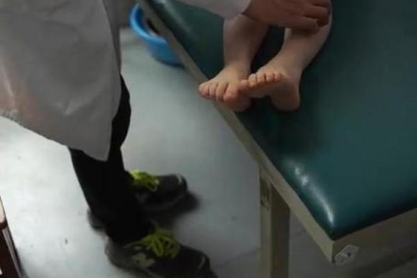 宝宝学走路外八字