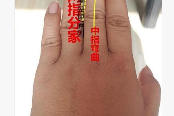 手指内侧长红胎记算命准吗
