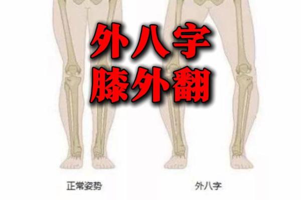 八字型腿