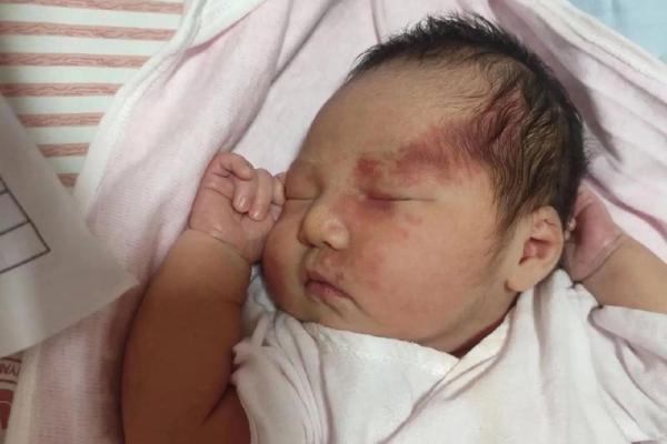 额头胎记算命有哪些影响-