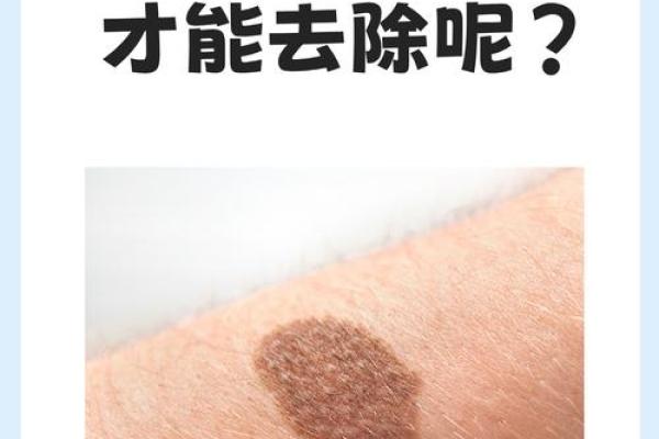 看胎记颜色类型算命