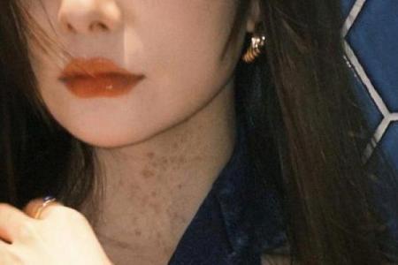 脖子上的胎记算命