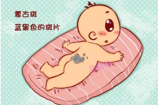 腿上有胎记算命分析