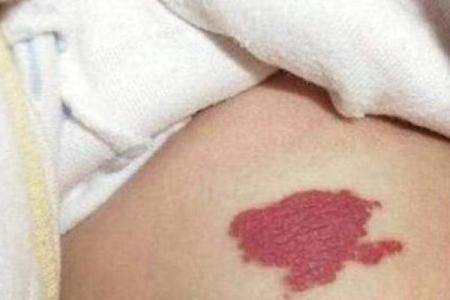 古算命，比较有福气的10处胎记