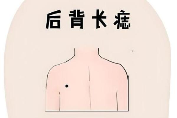 风水上后脑勺长痣代表什么意思