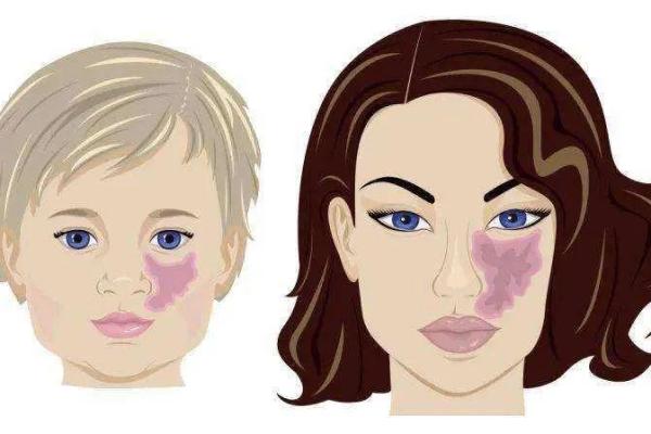 腿部不同位置的胎记算命分析-