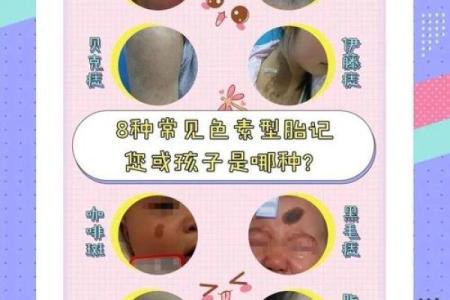 胎记算命的方法