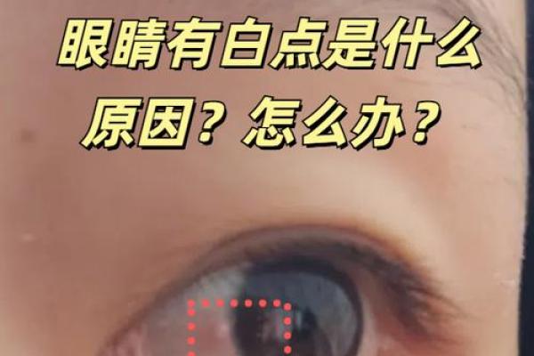 算命左眼白眼球有痣代