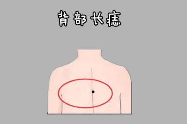 据脖子上胎记算命,有什么说法 据脖子上胎记算命,有什么说法