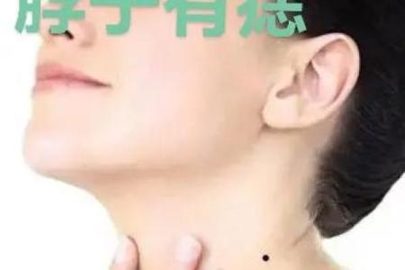 脖子痣看相算命吉凶
