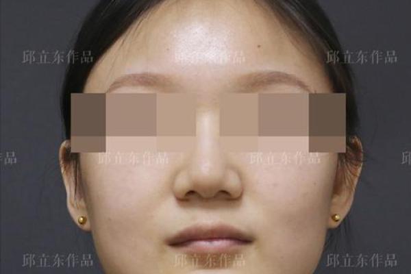 如何优化八字型下巴? 如何优化八字型下巴?