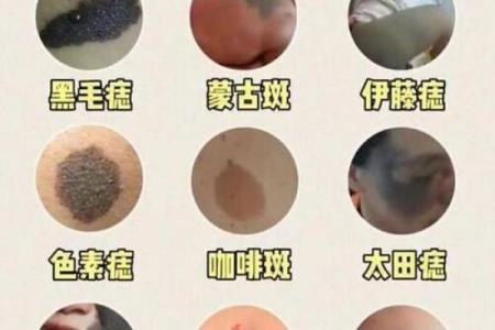 红胎记算命图解