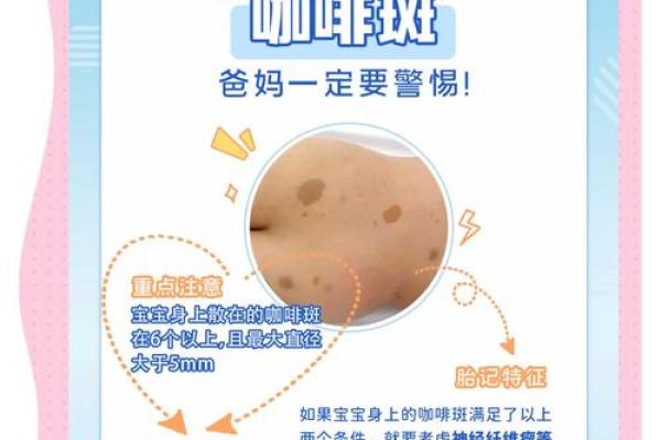 屁股有胎记算命分析 屁股有胎记算命分析