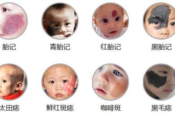 脸上各部位的胎记算命