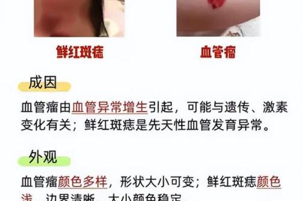 脸上各部位的胎记如何分析算命？