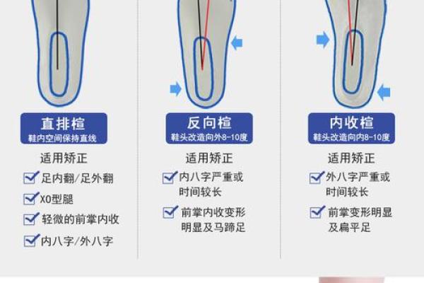 矫正外八字