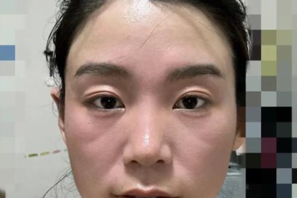 八字纹填充 八字纹填充