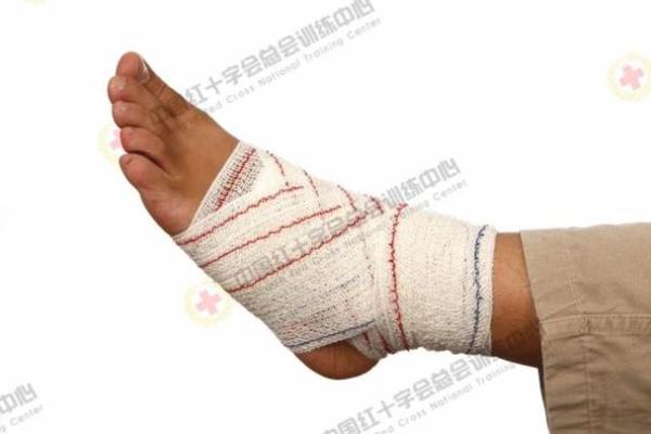 八字包扎法 八字包扎法