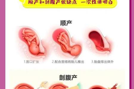 剖腹产的八字