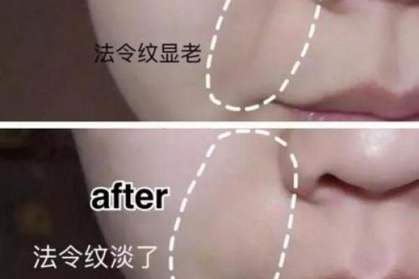 八字纹怎么去除 八字纹怎么去除