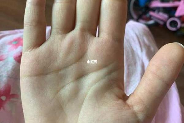 胎记的位置与运势算命