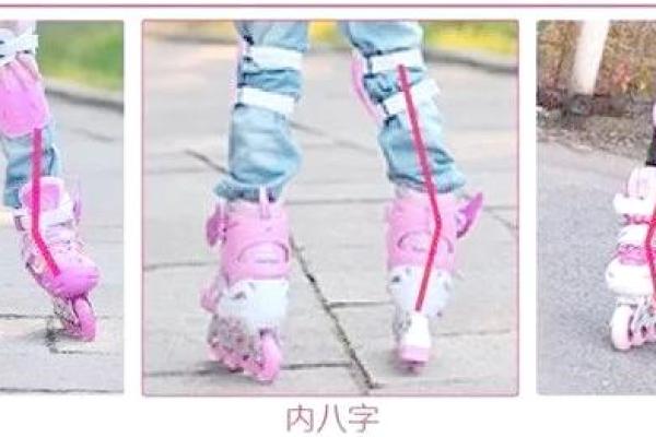 轮滑内八字