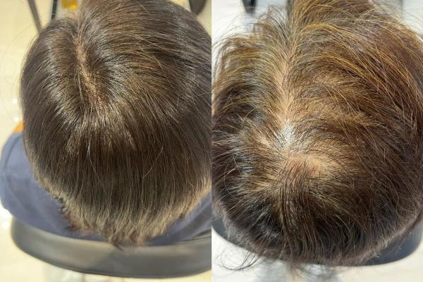 头发稀少的八字特征 八字头发稀少